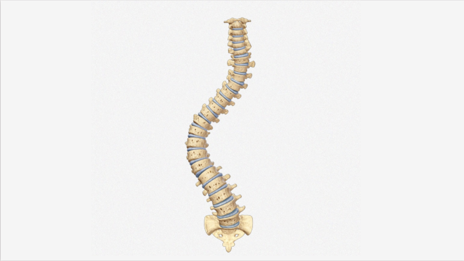 Escoliosis degenerativa