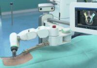 Cirugía robótica Vithas