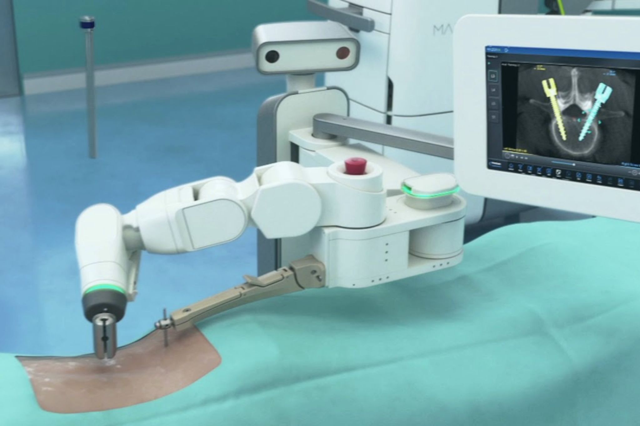 La cirugía robótica llega a Neurocirugía de Vithas Vigo 