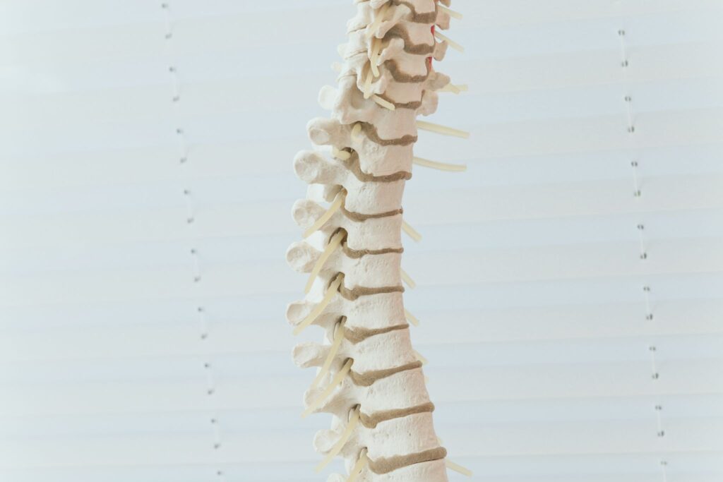 Complicaciones más frecuentes de la cirugía de columna.