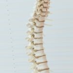 complicaciones frecuentes cirugía de columna