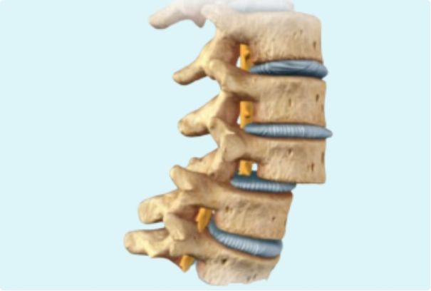 Listesis vertebral