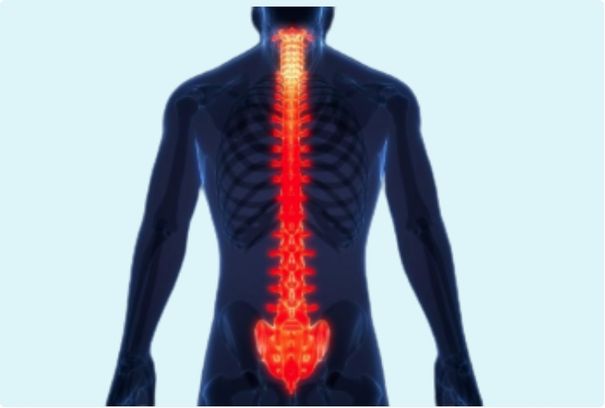 Infecciones vertebrales